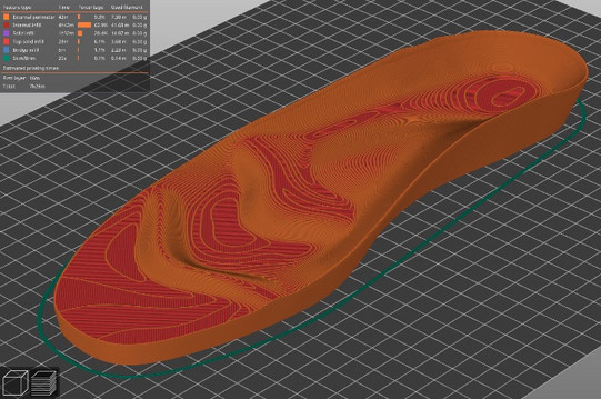 3D slicer model of a footbed (full view)