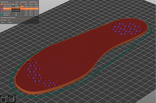 3D-Slicer Model einer Fußbettung (Teil Ansicht)